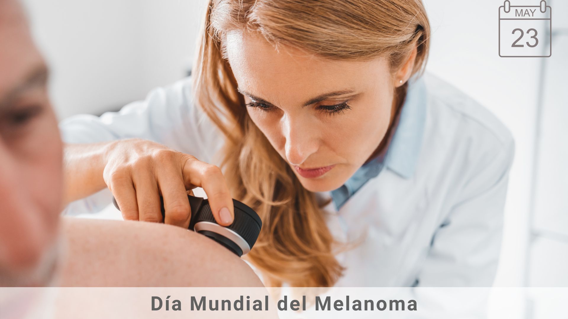 23 DE MAYO: DÍA MUNDIAL DEL MELANOMA